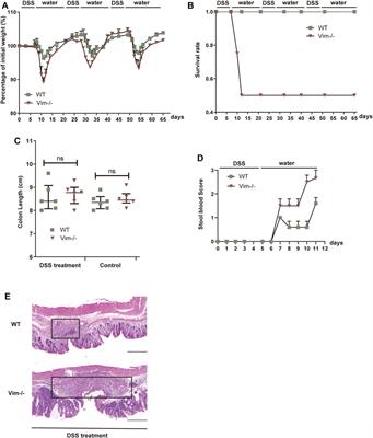 Vimentin Suppresses Inflammation and Tumorigenesis in the Mouse Intestine